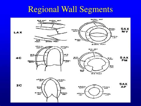 lv wall segments echo|echo wall segments labeled.